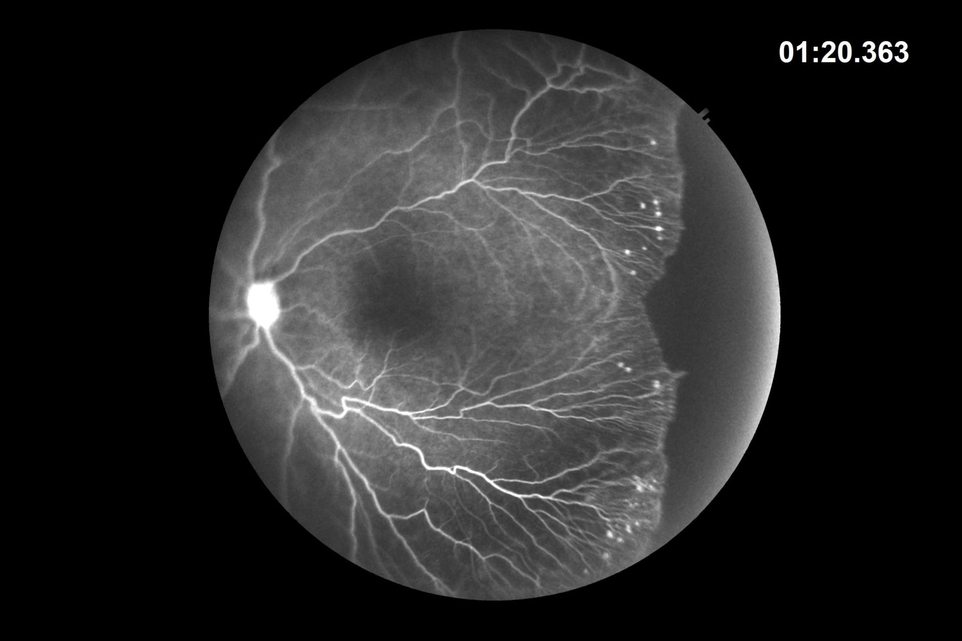 neo HDFA scan 1.20