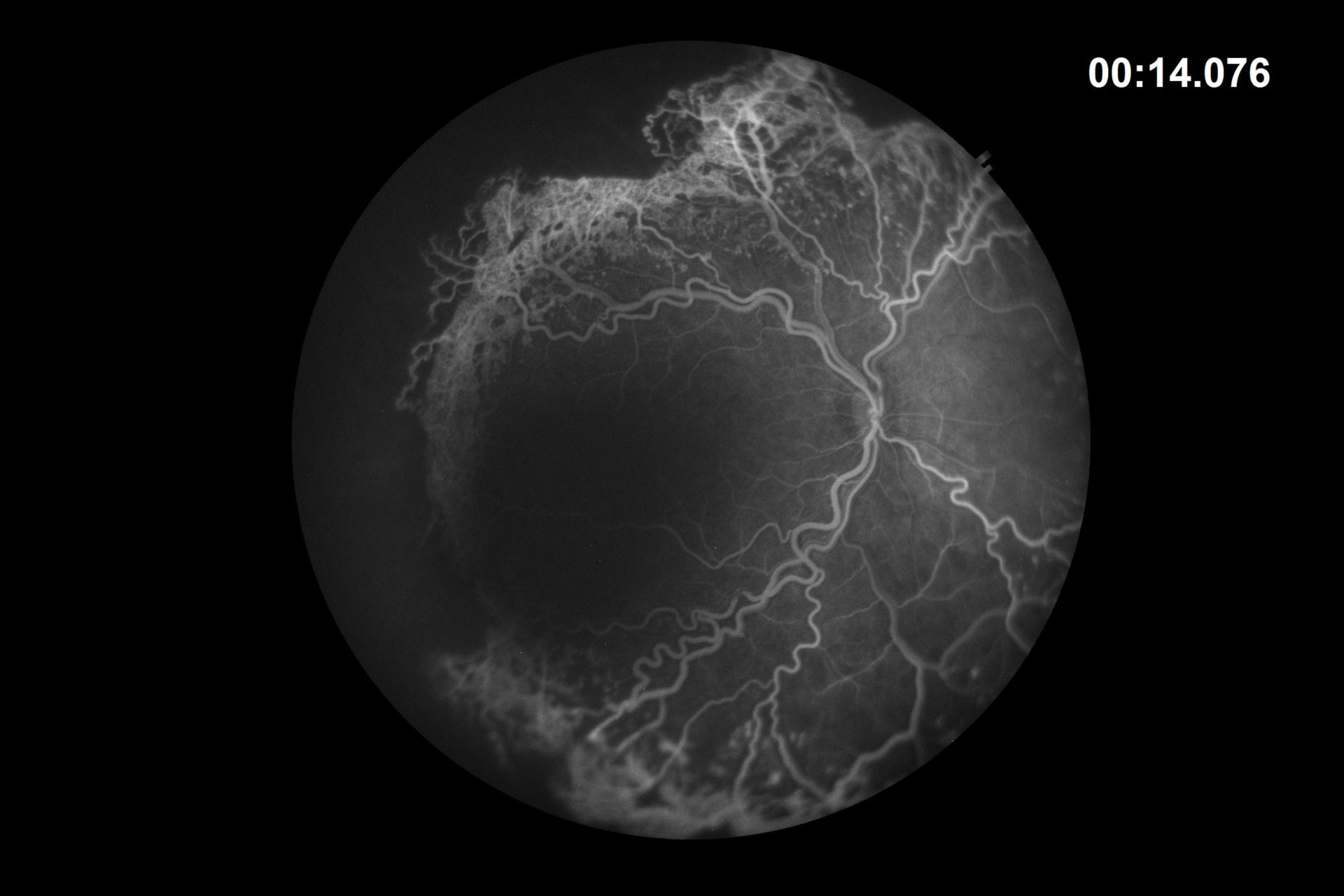 neo HDFA scan 14