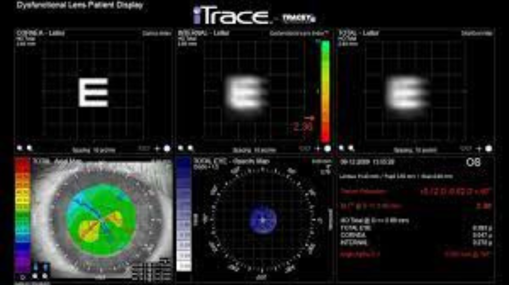 iTrace eye scan 3
