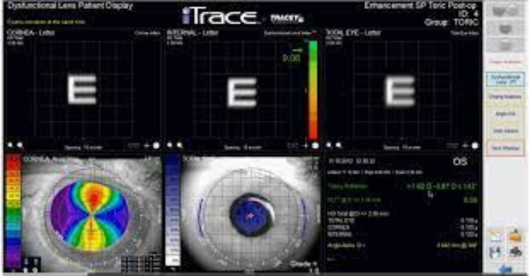 iTrace eye scan 2