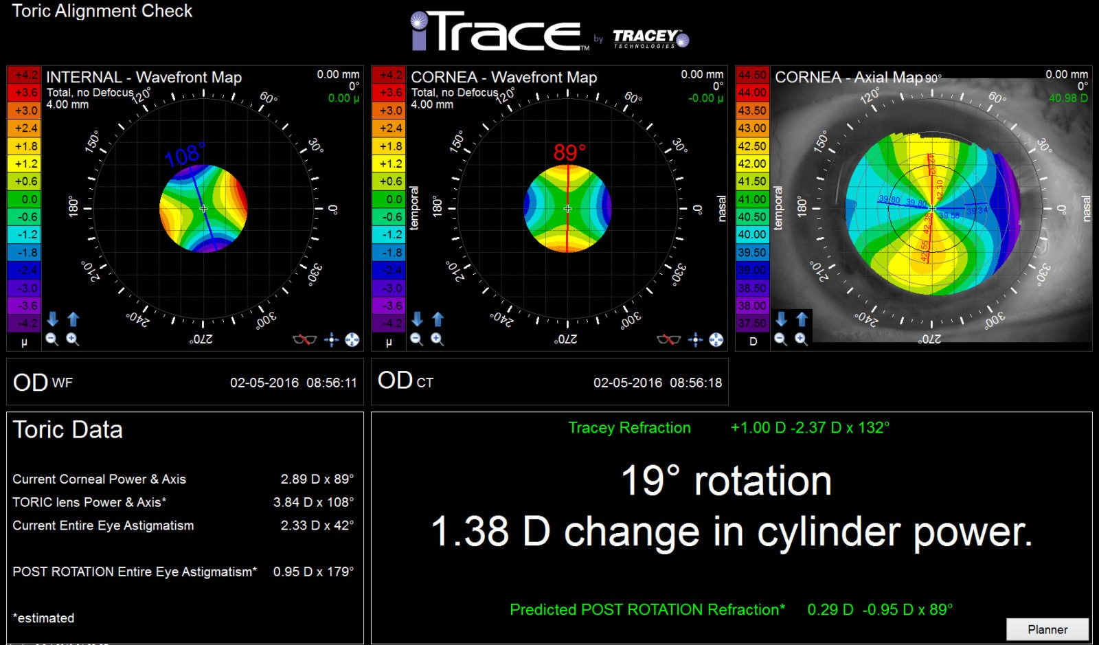iTrace eye scan 1