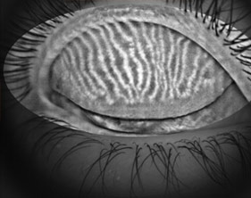 fundus camera