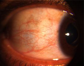 ophthalmology fundus camera